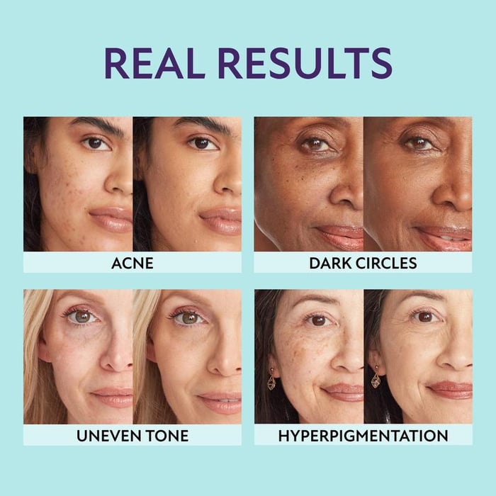 AquaLustre™ – The All-in-One Concealer for Effortless Glow