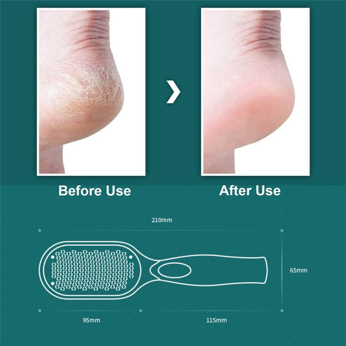 SilkStride™ - Foot Callus Remover for Smooth, Soft Feet
